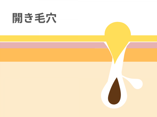 毛穴　スキンケア　札幌　美容　乾燥　開き毛穴　たるみ毛穴　黒ずみ　冬